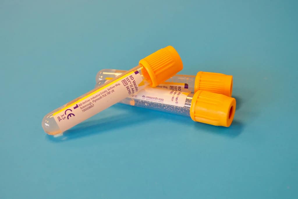 Luxury Biohacking Lifestyle — Technologies & Protocols for UHNW Clients 3 Test tubes for a biological age test